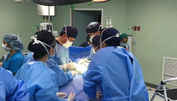 Médicos estudian cómo separar a 2 siameses unidos por la cabeza. | Foto: Facebook / Captura