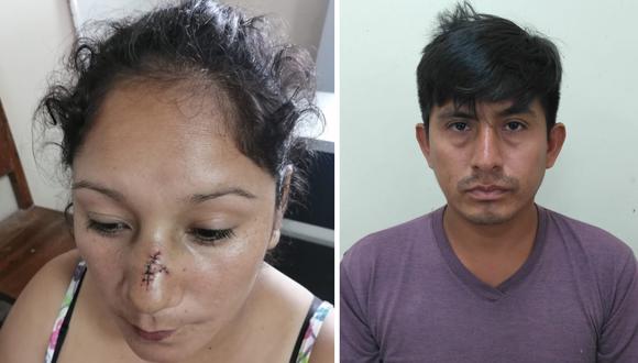 El sujeto, que ya fue capturado por la Policía, reconoció que atacó a su pareja, pero culpó al alcohol. (Fotos: PNP)