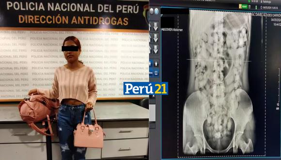 Joven es capturada con droga en su estómago en el Aeropuerto Jorge Chávez. (Composición)