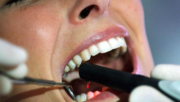En Estados Unidos, el 27 % de los adultos presentan caries dentales que no han sido tratadas. (Foto referencial: EFE)