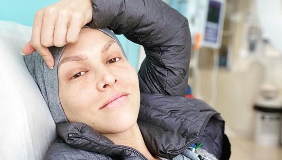 Anahí de Cárdenas se sinceró sobre sus cambios físicos por el cáncer de mama: “Aprendí a quererme como soy”. (Foto: Instagram)
