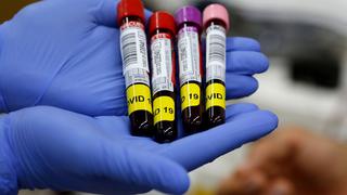 Bolivia diseña ley que obligará a recuperados de coronavirus a donar su plasma para tratamiento de contagiados