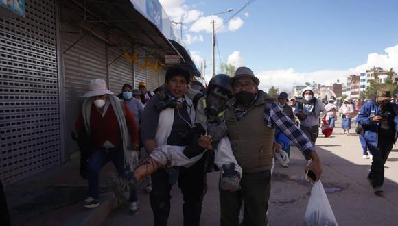 JULIACA. El fotógrafo Aldair Mejía recibió, en enero último, un proyectil en la pierna por parte de la Policía. (Foto: ANP)