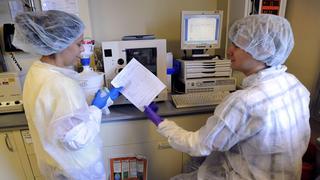 Nuevo test para detectar anticuerpos contra el virus del sida