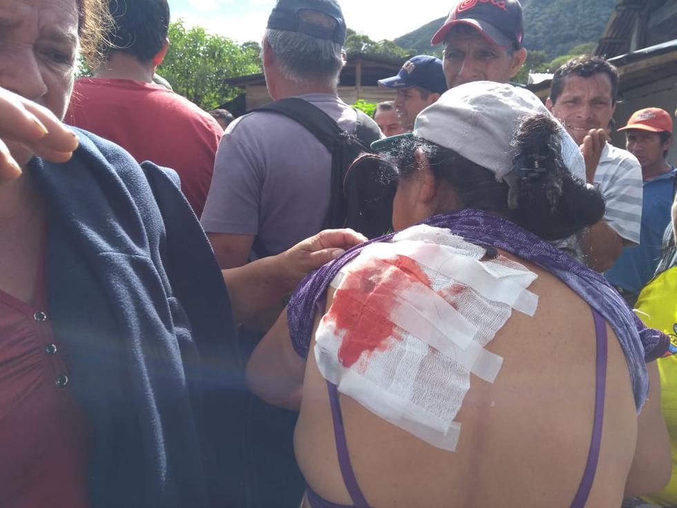 Varios heridos dejó enfrentamiento en Amazonas (Sqala TV)