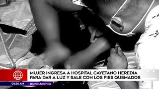 Mujer da a luz en el hospital Cayetano Heredia y termina con los pies quemados