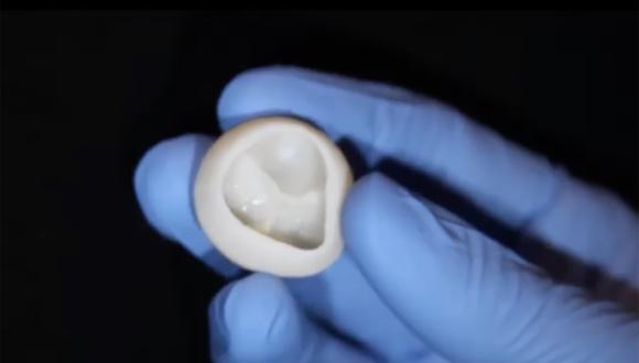 Una válvula cardíaca funcional que un equipo de científicos estadounidenses ha construido con colágeno utilizando una bioimpresora 3D. (Foto: AFP)