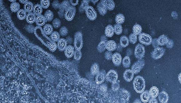 El virus fue descubierto por primera vez en una persona a finales de marzo. (AP)