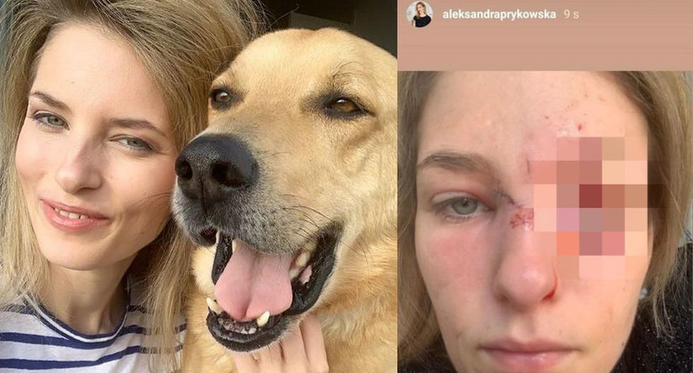 Aleksandra Prykowska: “Vi mi ojo empapado en sangre”. Este es el brutal ataque de un perro contra la modelo que lo rescató de un refugio de animales. La actriz y modelo polaca fue desfigurada por su mascota. Ahora, ella tiene miedo de que el animal, que ya devolvió al refugio, pueda atacar a la siguiente familia que lo adopte. (Instagram - @aleksandraprykowska)