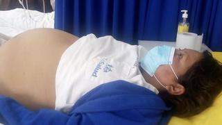 Cirujanos de EsSalud extirpan tumor gigante a tacneña de 38 años que tenía la apariencia de llevar un embarazo de 8 meses