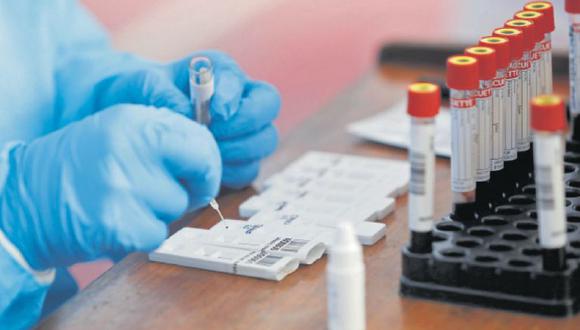 Prueba de fuego. Susalud realiza una investigación sobre el presunto cobro de clínicas por las muestras procesadas en el INS.