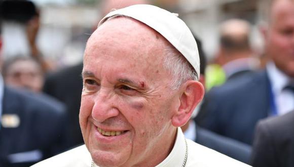 Colombia: El papa Francisco sufre golpe en el rostro por querer saludar a niño. (AFP)