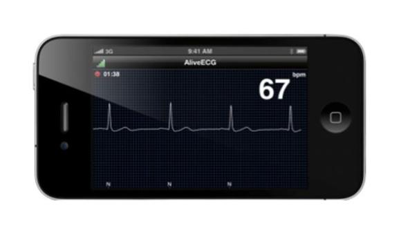 El AliveCor se conecta al iPhone y funciona como electrocardiógrafo. (USI)
