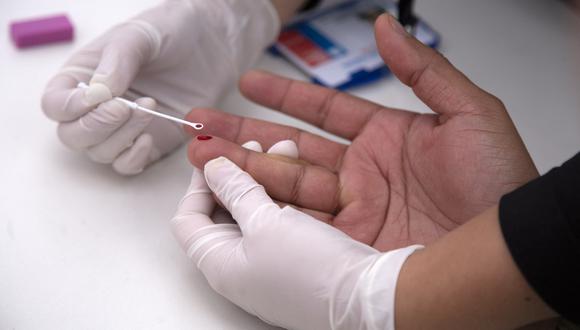 Un hombre se realiza una prueba rápida de VIH. (Foto: CLAUDIO REYES / AFP)