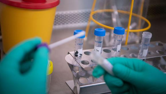 Solo el INS puede tomar las pruebas para el descarte de coronavirus. (Foto: AFP)