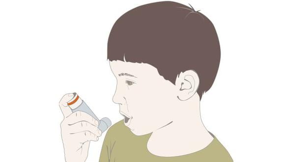 ¿Sabes qué es el asma y cuándo solicitar asistencia médica? (Gettyimages)