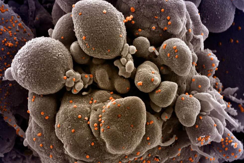 Este es el verdadero aspecto del coronavirus captado en una serie de fotografías microscópicas. (NIAID)