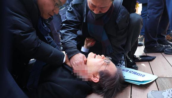 Lee Jae-myung fue apuñalado en el cuello. (Foto: EFE/EPA/YONHAP)