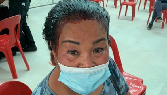Una mujer acudió a su centro de vacunación con su cabello a medio pintar por enterarse a último momento  (Foto: Facebook)