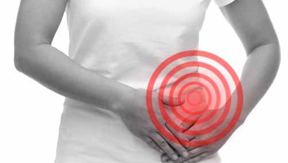 Cáncer de ovario: Siga estas recomendaciones para luchar contra neoplasia