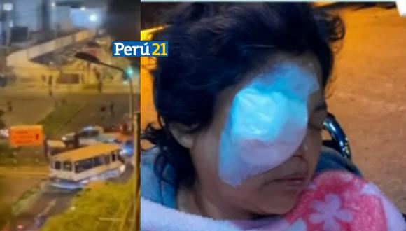 Mujer pierde la vista de un ojo tras enfrentamiento entre supuestos barristas. (Foto: Buenos Días Perú).