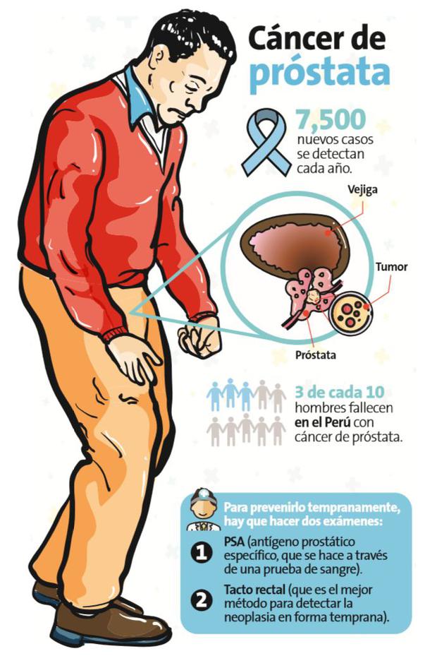 neoplasia prostata sintomas