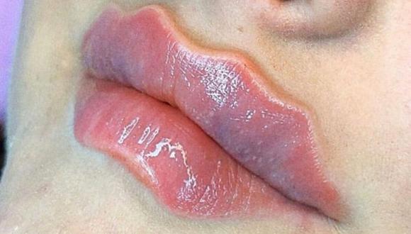 La creadora de esta curiosa técnica fue la cosmetóloga rusa Alexandra Gont, quién señalo que el procedimiento es completamente seguro y no presenta riesgos para la salud. ( Foto: Instagram)