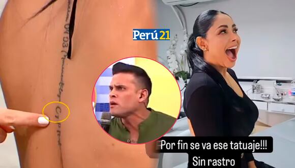 Pamela Franco se elimina tatuaje en nombre de Christian Domínguez