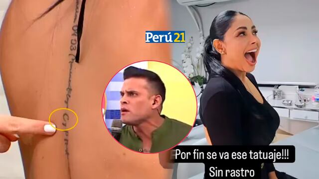 Pamela Franco se borra tatuaje en nombre de Christian Domínguez: “No dejé rastro de eso” | VIDEO 
