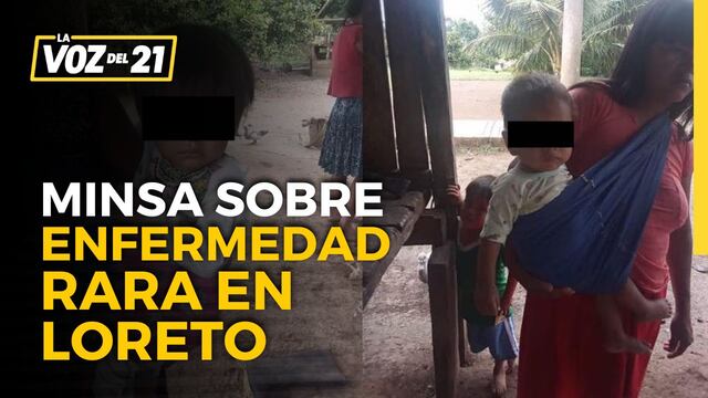 César Munayco del Minsa sobre enfermedad en Loreto: “No es una enfermedad rara”
