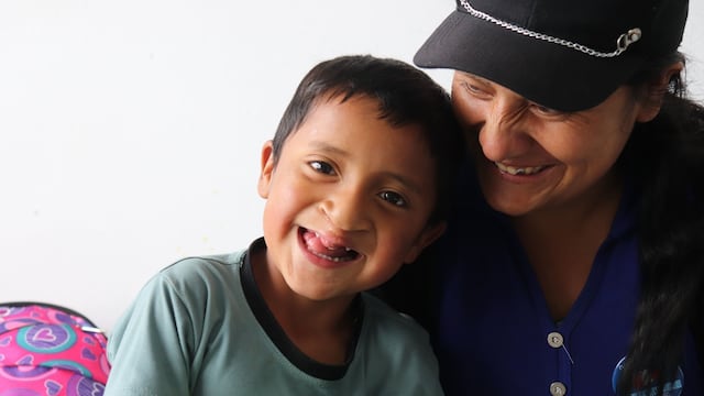 Operación Sonrisa realiza actividad para apoyar a pacientes con labio fisurado y paladar hendido