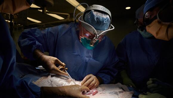 Un equipo médico de EE. UU. trasplanta el riñón de un cerdo a una persona. (Foto de Joe Carrotta / NYU Langone Health / AFP)
