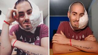 “Ya no sufre más”: Falleció Sebastián Amurín, el joven que tenía un tumor cancerígeno en su rostro