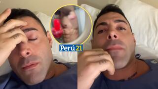 Sebastián Lizarzaburu llora tras revelar que padece infección bacteriana en la piel [VIDEO]
