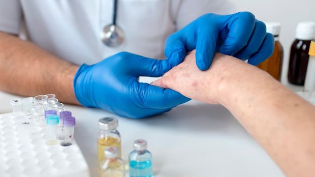 Ministerio de Salud detecta caso de sarampión en bebé de 10 meses