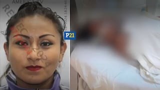 ¡Justicia para Soledad! Mujer que fue quemada por su pareja lucha por su vida