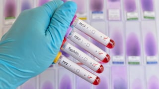 ¡Buenas noticias! Confirman tercer paciente que se cura del VIH en Alemania