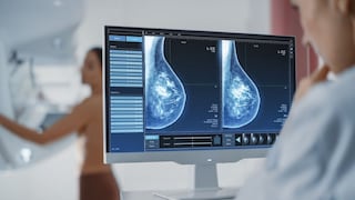 Piden acelerar ley que permite a municipios adquirir mamógrafos y ayudar a detectar casos de cáncer