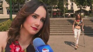 Angélica Díaz: El caso de la modelo venezolana que perdió una pierna por negligencia médica