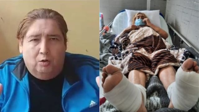 ‘Tongo’ denuncia que le quemaron los pies en hospital y teme sufrir amputación  