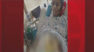 Hospital Sergio Bernales suspende a médicos por dejar gasa dentro de paciente