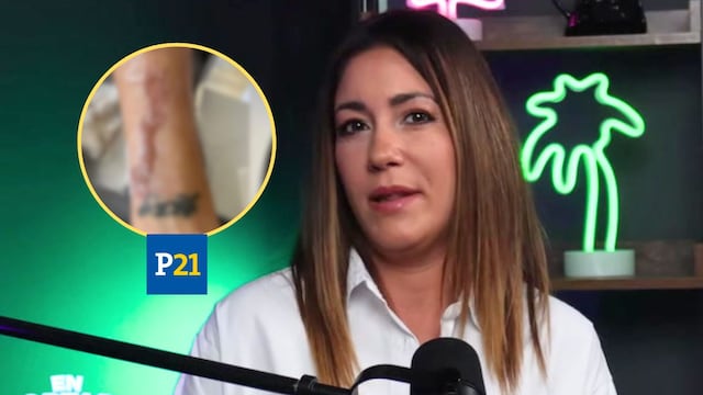 Tilsa Lozano no se someterá a injerto de piel tras graves quemaduras en ‘El Gran Chef’