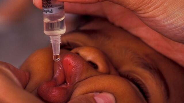 Día Mundial Contra la Polio: ¿Cómo prevenir esta enfermedad que no tiene cura? 