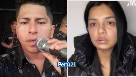 Pese a la gravedad de las lesiones reportadas, la Policía Nacional del Perú (PNP) dejó en libertad al cantante. (Foto: Difusión).