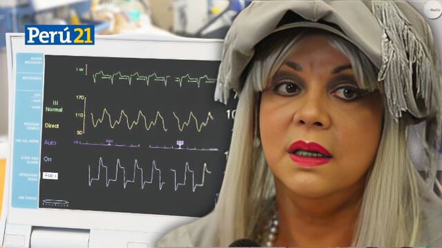 Yola Polastri y la vez que fue diagnosticada con aneurisma cerebral: “Me dijeron que iba quedar parapléjica” (VIDEOS)