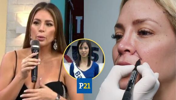 Sheyla Rojas no está conforme con su apariencia tras serie de retoques estéticos (Foto: América TV / captura video)