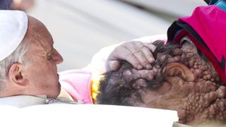 Papa Francisco conmueve con abrazo a un hombre enfermo