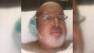 Carlos Bruce muestra foto sobre su recuperación del cáncer de piel