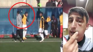 Bolivia: Entrenador recibe un piedrazo en el rostro, reclamó y fue expulsado por el árbitro