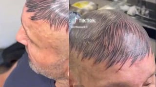 Una idea descabellada: Hombre se tatuó cabello en su cabeza rapada para disimular su calvicie